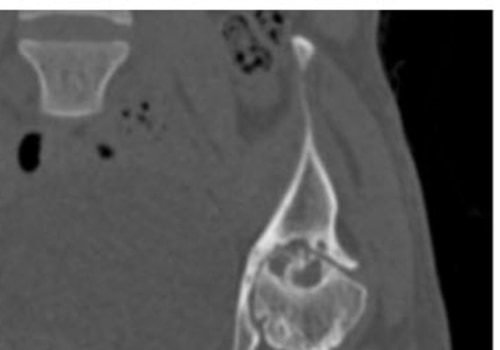 What is an Ion Chamber in Radiology? A Comprehensive Guide